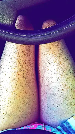 pics freckle porn